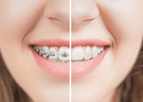 before-after